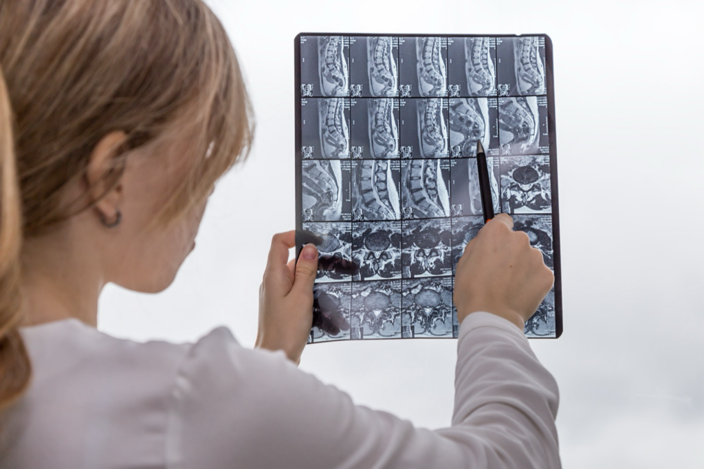 Medical professional reviewing spine MRI images that guide treatment after a car accident